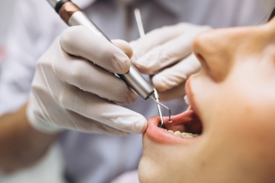 Implantología avanzada en la Clínica dental Torremolinos