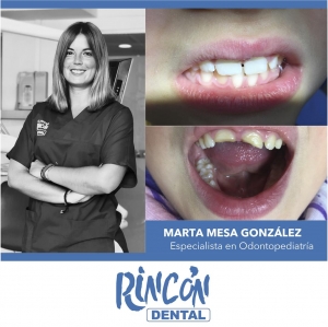 Marta Mesa González | Especialista en Odontopediatría