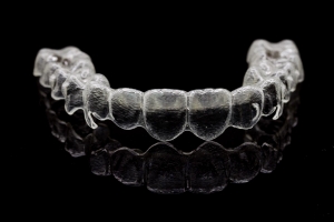 Alineadent | Removable braces